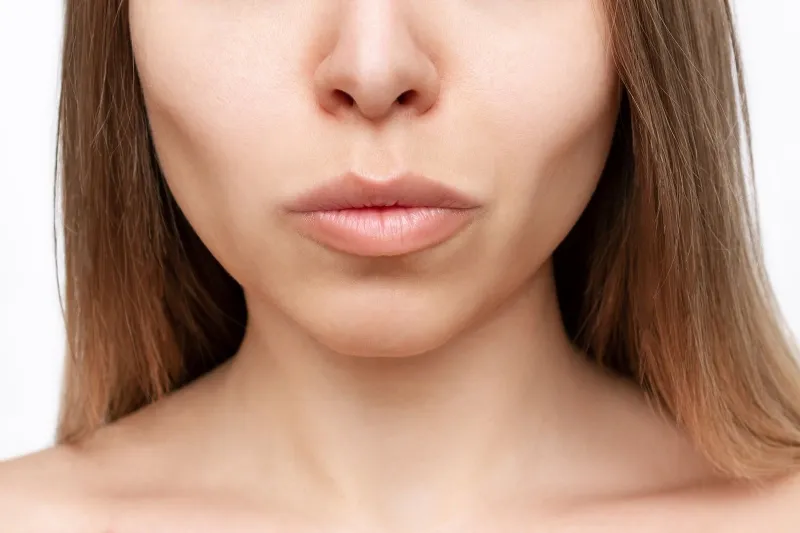 Individuals with sunken cheeks or temple hollowing who wish to enhance their facial contours with a non-surgical treatment may be suitable candidates for Restylane® Contour.