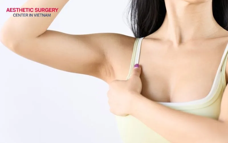 People with stable weight, localized fat, firm skin, and good health are highly suitable for armpit liposuction.