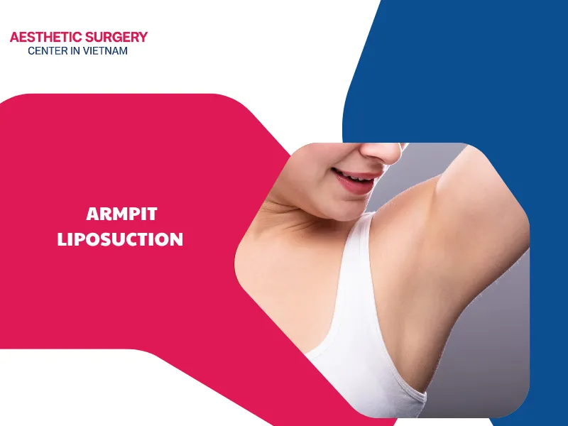 What is armpit liposuction? Ideal candidates, benefits and costs