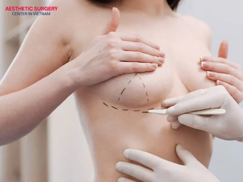 An appropriate anesthesia method should be selected for the revision procedure to ensure safety.