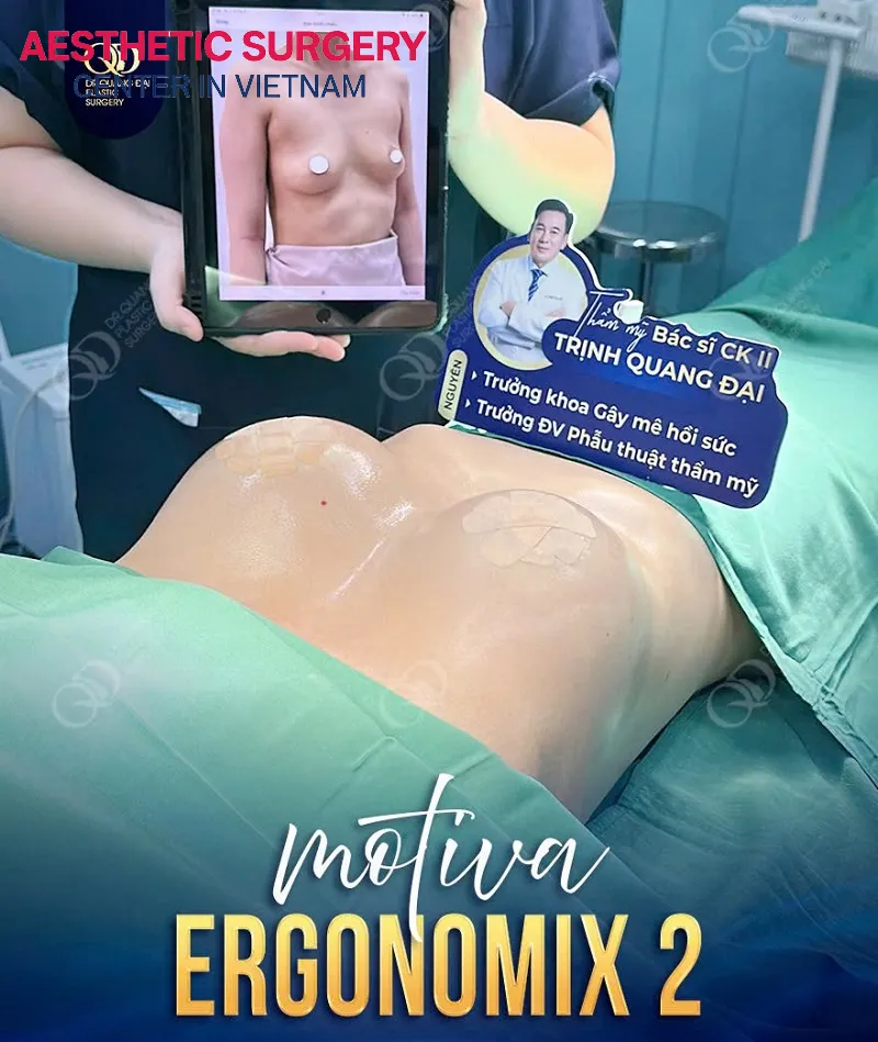 A perfectly successful breast augmentation performed by Dr. Trinh Quang Dai.