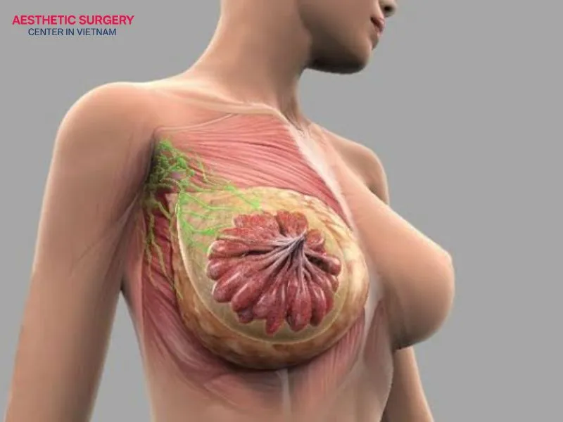 Breast implant removal and total capsulectomy are the most definitive treatment for eliminating breast implant illness symptoms.