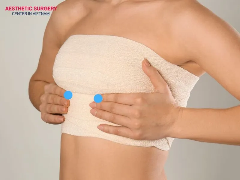 From the first month, the breast shape begins to stabilize, so you may no longer need to wear a compression garment.