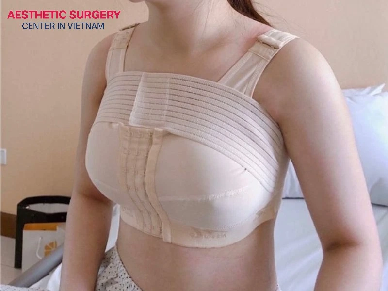 Wearing a medical compression bra stabilizes implant position and protects healing tissue from excess movement.