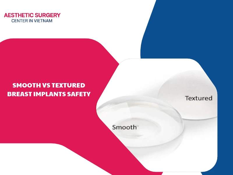 Comparing safety: Smooth vs textured breast implants safety