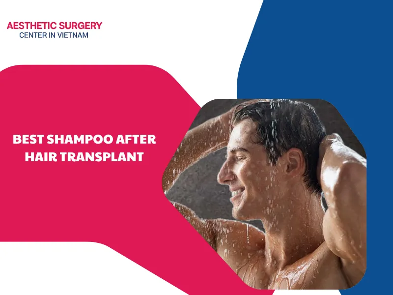 Best shampoo after hair transplant: Top options for fast healing