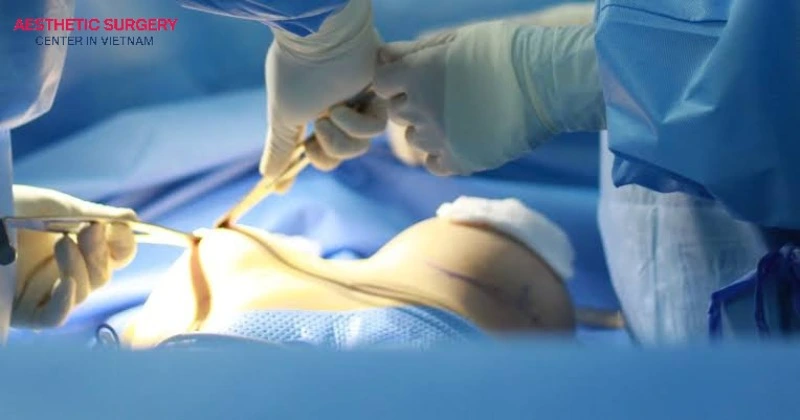 The procedure is performed by qualified plastic surgeons with expertise in gender-affirming surgery.