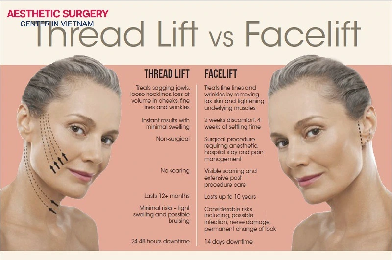 Surgical facelift and thread lift have clear differences.
