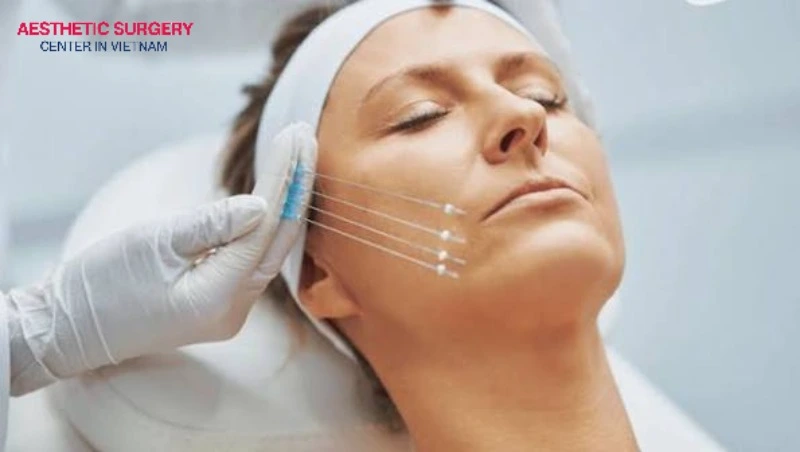 A thread lift is suitable for individuals with mild sagging and loose skin.