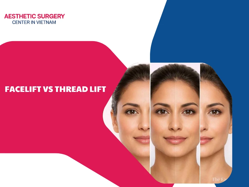 Facelift vs thread lift: Which method should you choose?