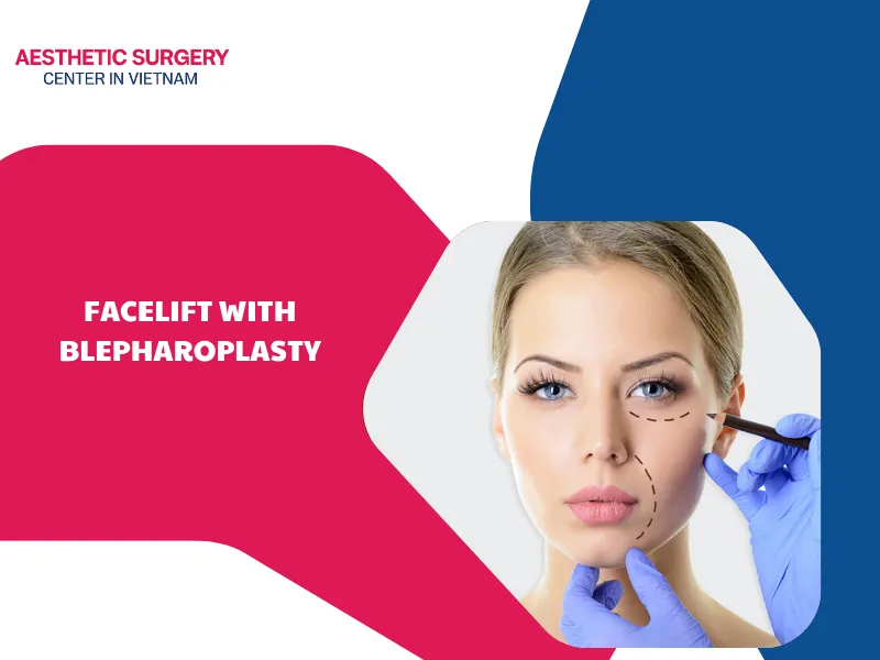 Facelift with blepharoplasty: Procedure guide and candidacy