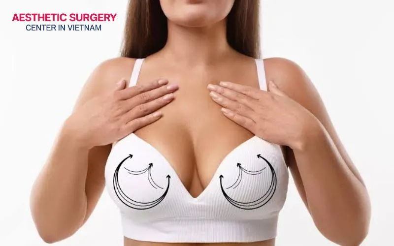 Candidates for free nipple graft breast reduction should be in stable physical health and commit to stopping smoking.