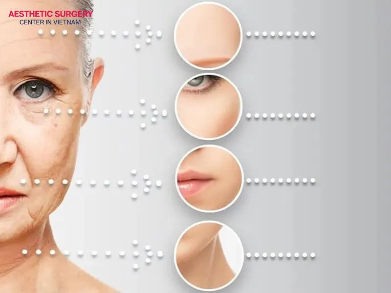 The mid-facelift surgery is performed according to standard medical procedures.