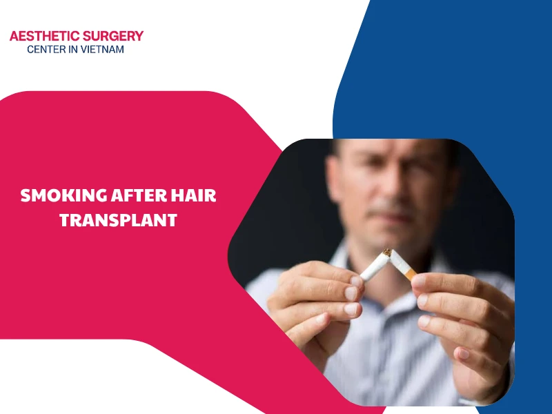 How harmful is smoking after hair transplant?