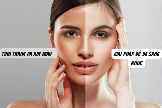 da xỉn màu