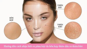 Làm sao phân biệt da hỗn hợp với các loại da khác?