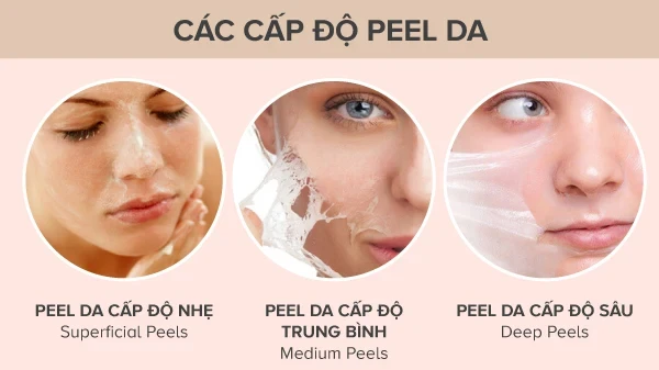 Có những loại peel da nào phù hợp với da bị tàn nhang?
