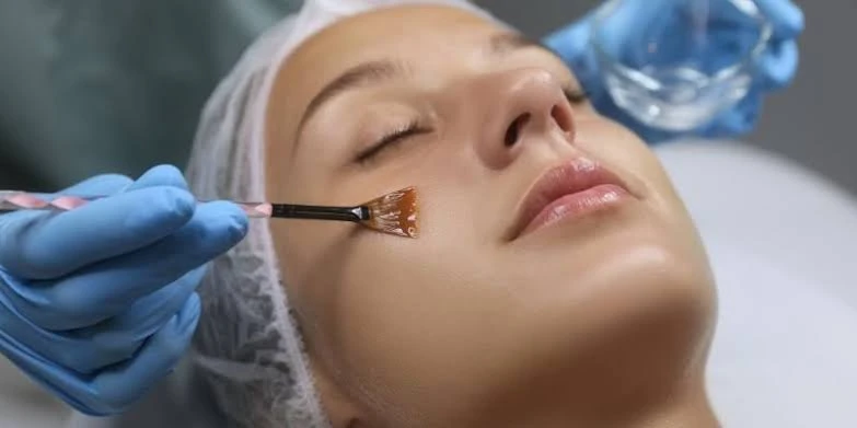 Peel da loại bỏ thế nào và có làm mỏng da không?