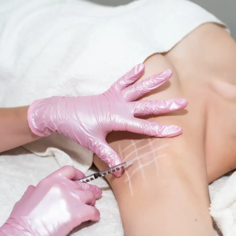 Botox hoạt động như nào
