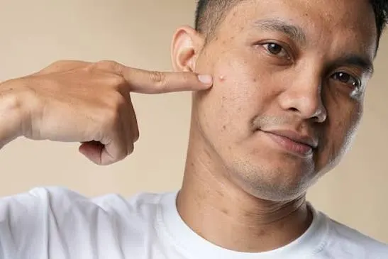 Mệt mỏi và rối loạn tâm thần: những dấu hiệu dễ bỏ qua của thiếu kẽm?