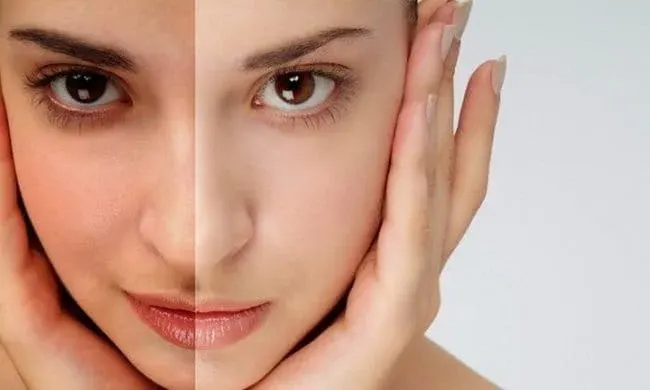 Cách trị da xỉn màu thiếu sức sống có nguy hiểm không?