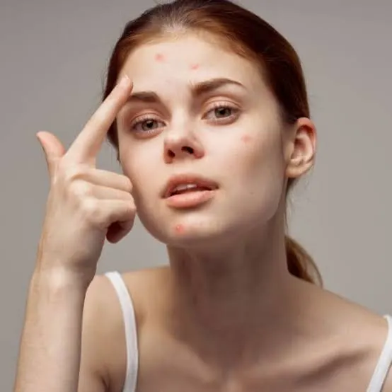 Cách chăm sóc tại nhà cho dấu hiệu rối loạn nội tiết nữ là gì?