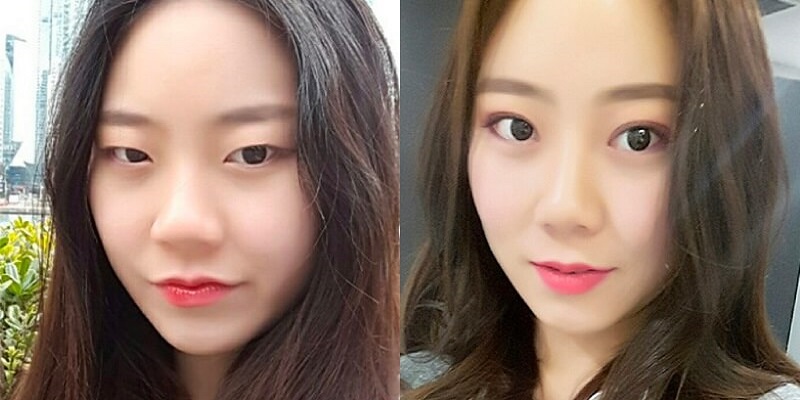Kết quả của một ca hạ mắt xếch thành công