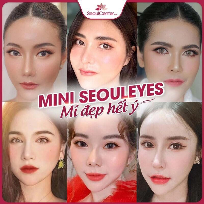 Seoul Center là địa chỉ nhấn mí vĩnh viễn uy tín, chất lượng hàng đầu hiện nay