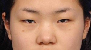 Hầu hết người Châu Á có mắt không mí do di truyền