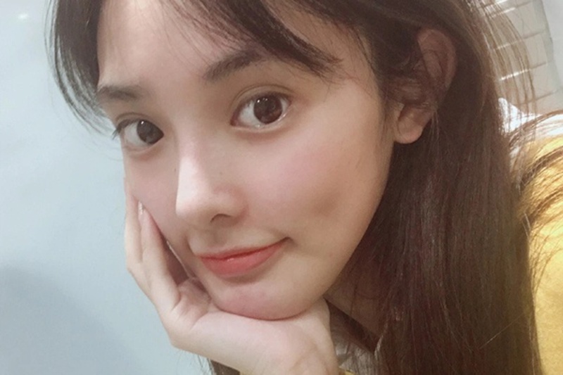 Mắt ốc lồi đẹp hay xấu còn phụ thuộc vào mức độ nặng, nhẹ của mắt và tổng quan gương mặtMắt ốc lồi đẹp hay xấu còn phụ thuộc vào mức độ nặng, nhẹ của mắt và tổng quan gương mặt