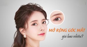 Chi phí mở rộng góc mắt chịu ảnh hưởng bởi nhiều yếu tố khác nhau