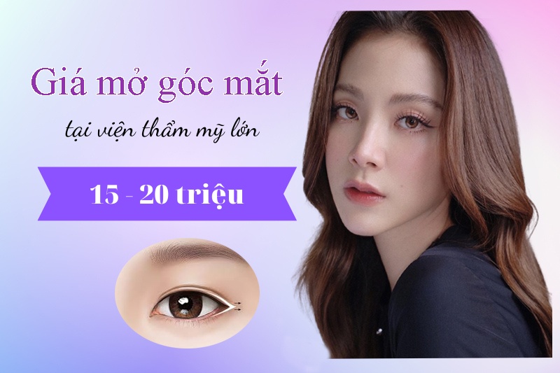 Chi phí mở góc mắt giá bao nhiêu còn phụ thuộc vào nhiều yếu tố khác