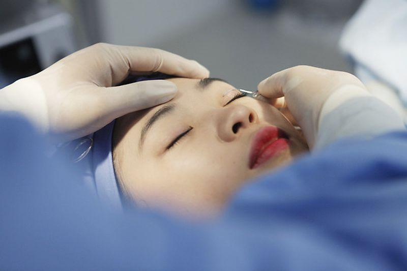 Công nghệ cắt mí chuẩn Hàn Quốc của JT Angel