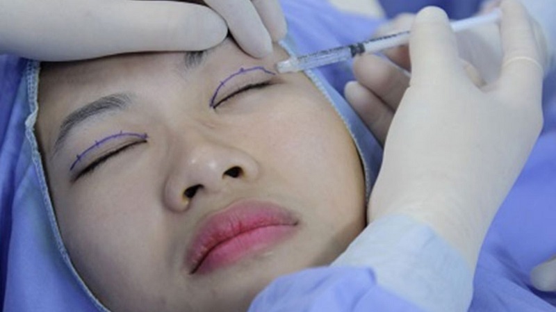 Lựa chọn  thẩm mỹ Hoa Đô cho đôi mắt 2 mí xinh đẹp rạng ngời