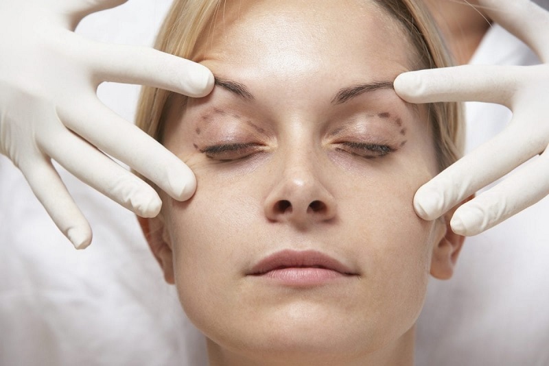 Lựa chọn bấm mí ở Kay Spa đảm bảo an toàn và chất lượng