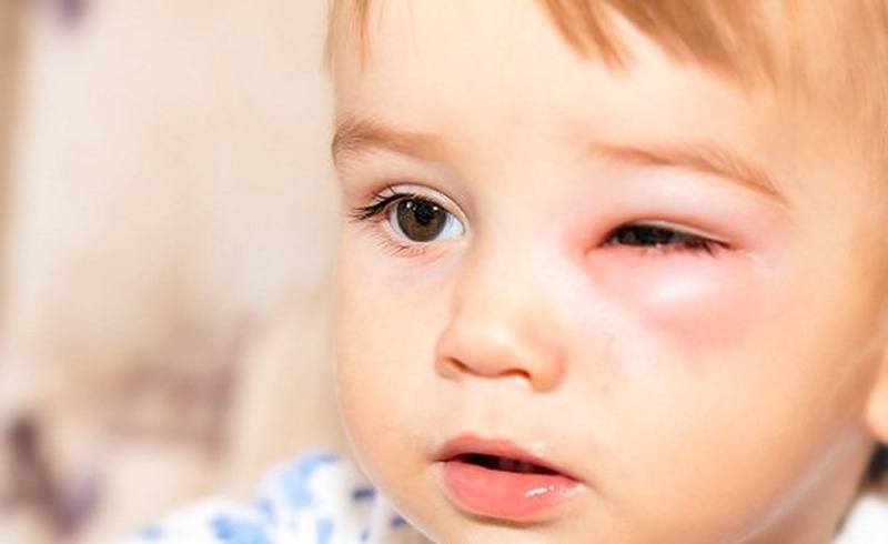 Cần can thiệp xử lý kịp thời trước khi xảy ra các biến chứng nghiêm trọng