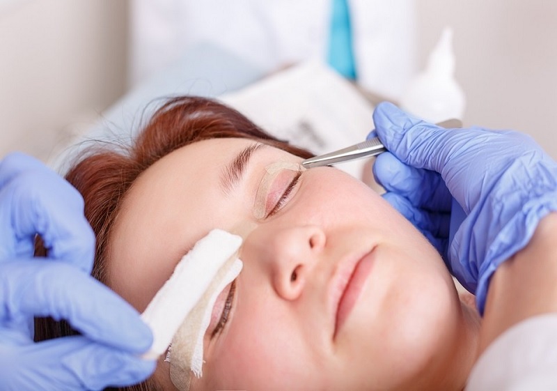 Thời gian để nếp gấp mí hết sưng sau phẫu thuật tùy thuộc vào nhiều yếu tố