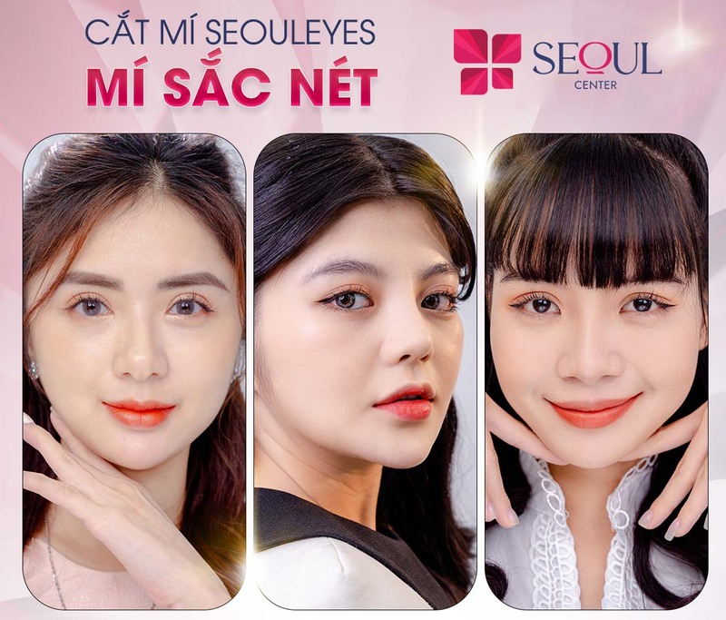 Seoul Center là địa chỉ cắt mí được nhiều khách hàng tin tưởng tại Hà Nội