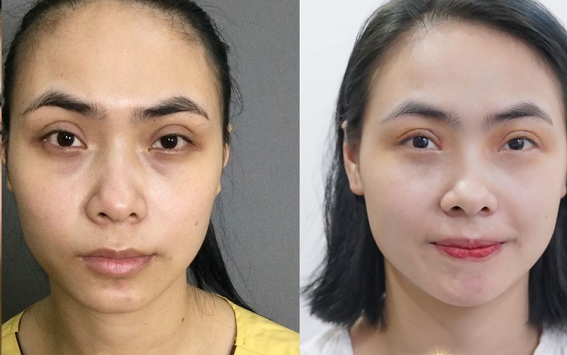 Thẩm mỹ viện Phú Xuân sở hữu đội ngũ bác sĩ chuyên nghiệp, tay nghề giỏi