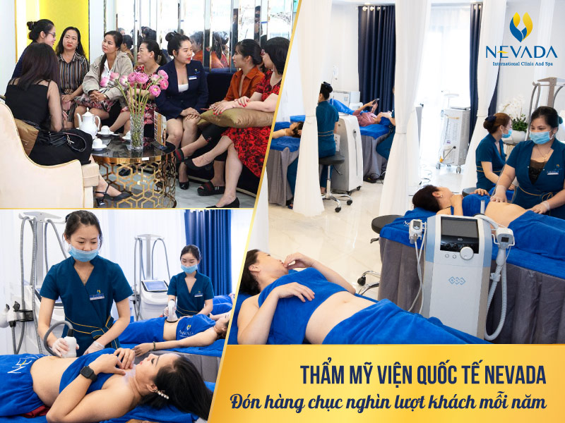 Thẩm mỹ viện Nevada là địa chỉ cắt mắt 2 mí to tròn, đẹp tự nhiên