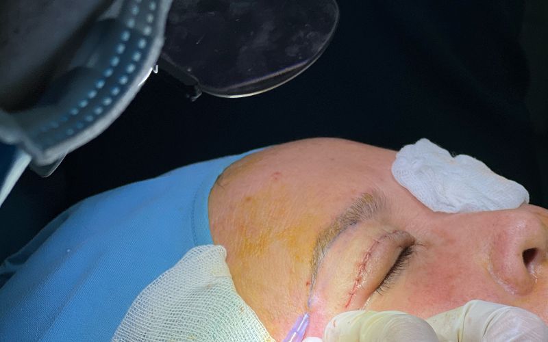 Thảo Nguyên Beauty có quy trình thẩm mỹ an toàn, tạo ra kết quả hoàn hảo