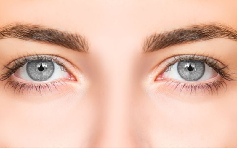 Số người sở hữu mắt màu xám trên thế giới là rất ít