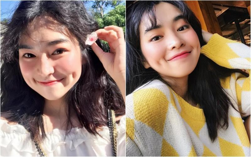 Nếu em bé sinh ra không có má lúm thì khi đủ tuổi có thể thực hiện phẫu thuật thẩm mỹ