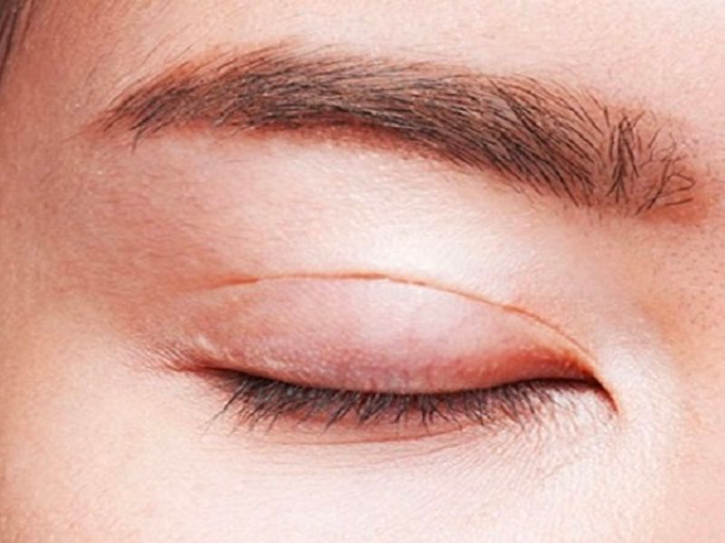 Tìm được một bác sĩ cắt mí đẹp là điều chị em luôn mong ước khi phẫu thuật cắt mí