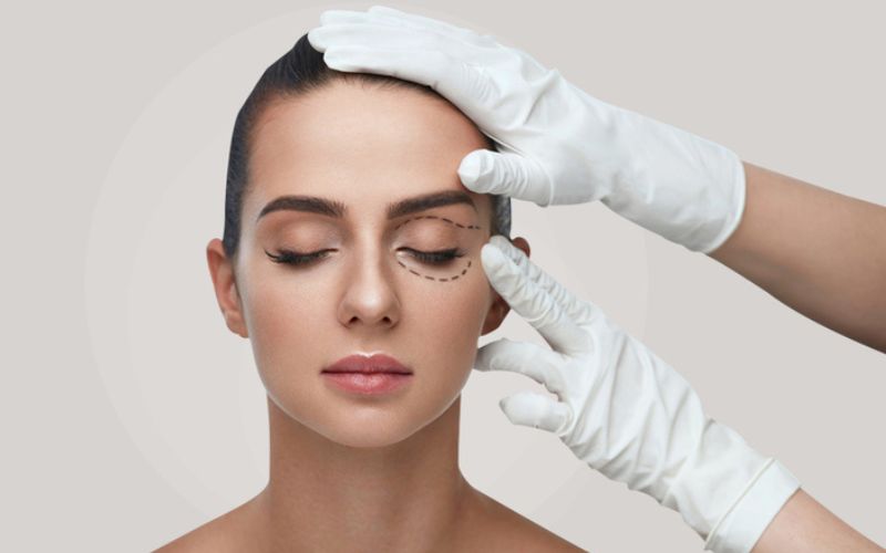 Cần lưu ý một số vấn đề khi làm tan mỡ mí mắt tại nhà