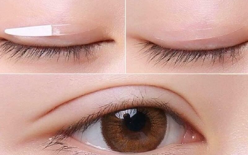 Dán kích mí giúp mắt 2 mí tự nhiên