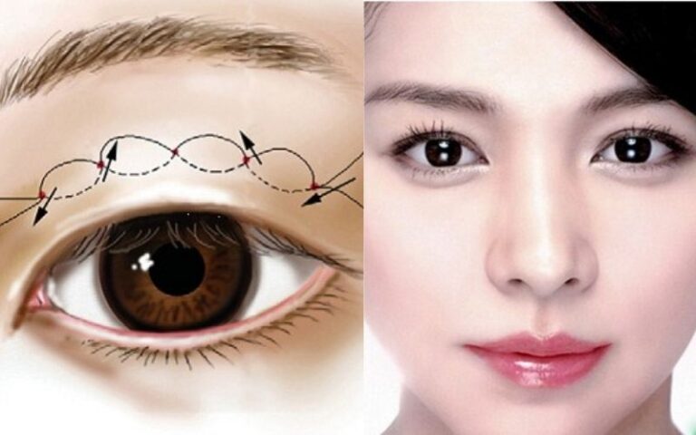 Mắt lá răm là gì? Đẹp hay xấu? Tiết lộ tướng số thú vị