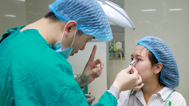 Nên tuân thủ lời khuyên không uống bia để đạt hiệu quả cắt mắt tốt nhất