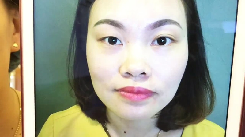 Mắt to mắt nhỏ gây ảnh hưởng xấu đến vấn đề thẩm mỹ và sức khỏe