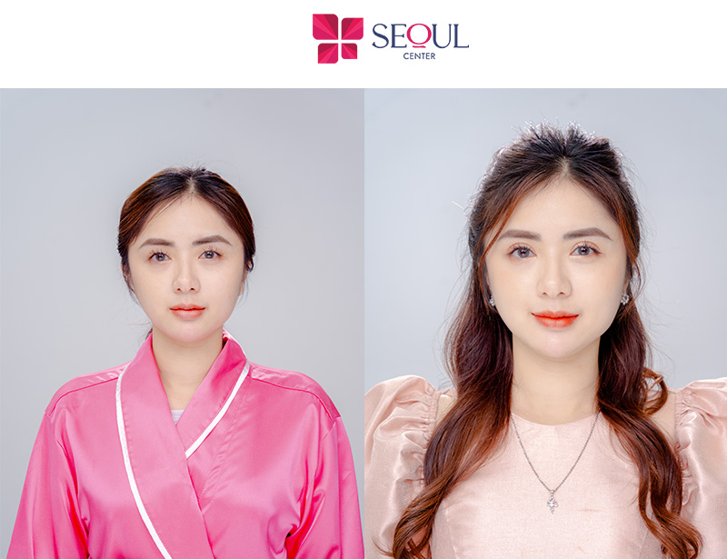 Đường mí mắt đẹp, mảnh giúp đôi mắt to tròn, cân đối hơn